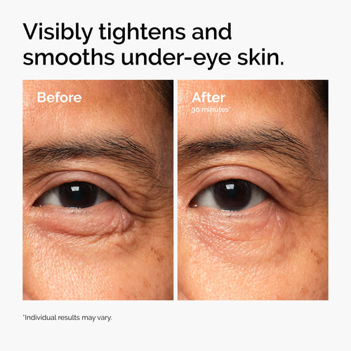 Lacto-PDRN Eye Cream 4% + B9
